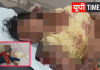 दो मासूम बेटियों संग मालगाड़ी के सामने कूदी महिला, तीनों गंभीर रूप से घायल